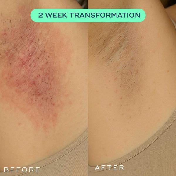 Luna Daily The Everything Oil For Ingrowns Redness & Bumps #4