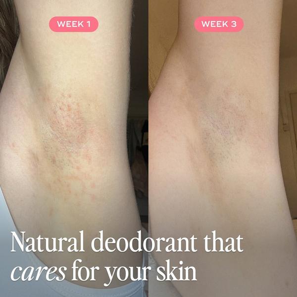 Luna Daily The All Over Deodorant #3