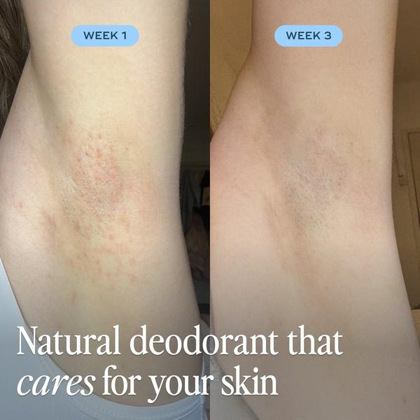 Luna Daily The All Over Deodorant #3