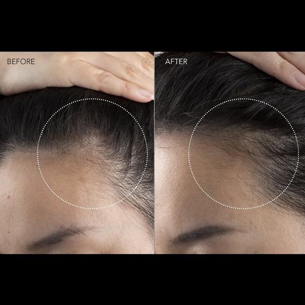 FOREO FAQ 301 LED Hair Strengthening Scalp Massager #6