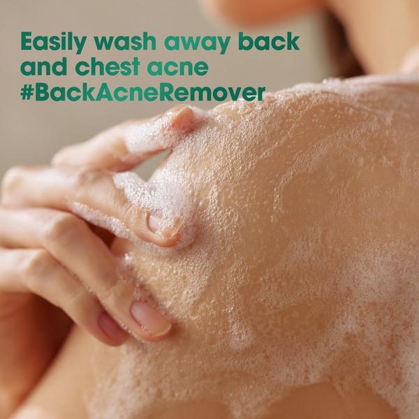 SOME BY MI AHA BHA PHA 30 Days Miracle Acne Clear Body Cleanser #6