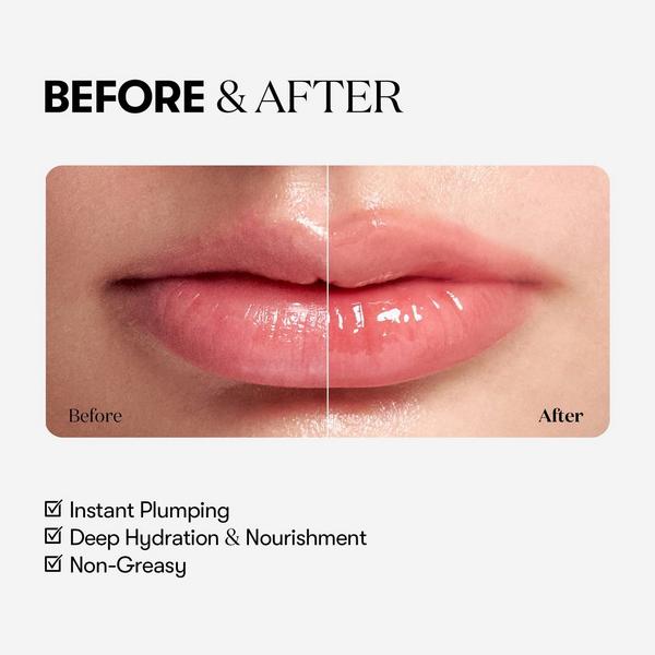 VT Cosmetics Reedle Shot Lip Plumper Beginner #4