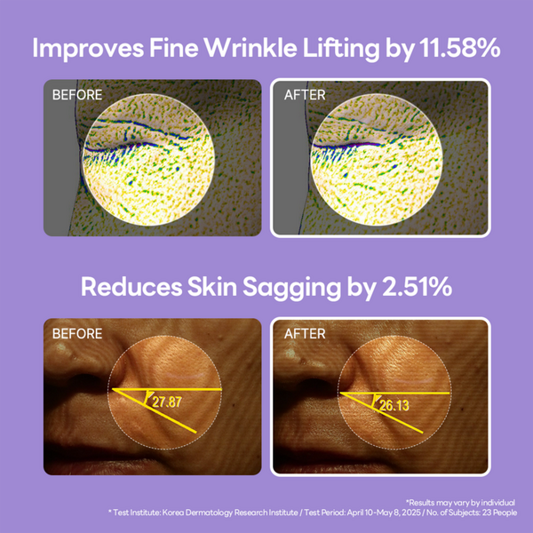 MEDIHEAL PDRN Lifting Serum #5