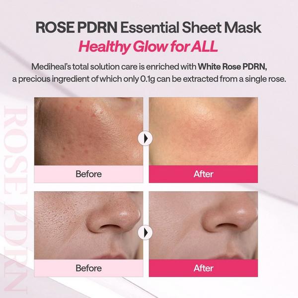MEDIHEAL Rose PDRN Essential Mask #5