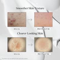 VT Cosmetics Reedle Shot 700 #3