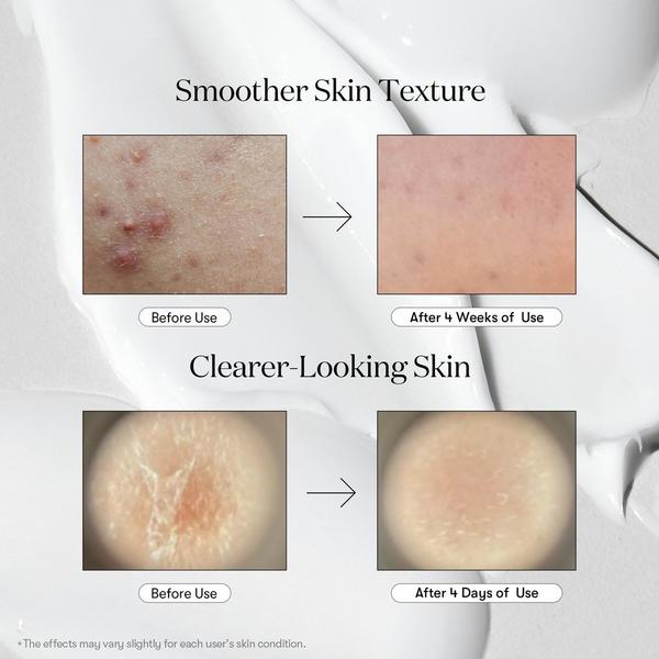 VT Cosmetics Reedle Shot 700 #3