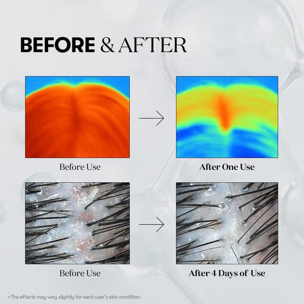 VT Cosmetics PDRN Reedle Shot Hair Ampoule 100dL #4