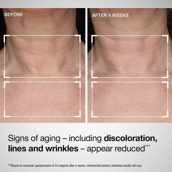 StriVectin TL Advanced Tightening Neck & Chest Lotion SPF 30 #5