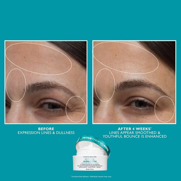 Peter Thomas Roth Full-Size​ Peptide Skinjection Face & Eye Kit​ #4