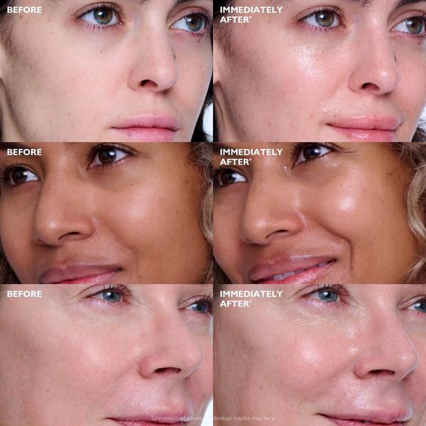 Peter Thomas Roth Collagen Skinjection Plumping & Firming Serum #3