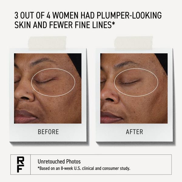 RODAN + FIELDS Pure C Serum #5