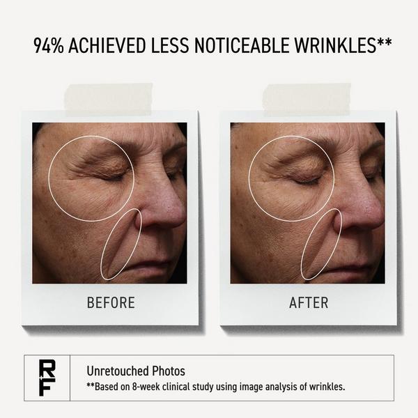 RODAN + FIELDS Pure C Serum #6