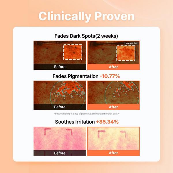 COSRX 5 PDRN Hyaluronic Acid Vital Hydrating Hydrogel Mask #6