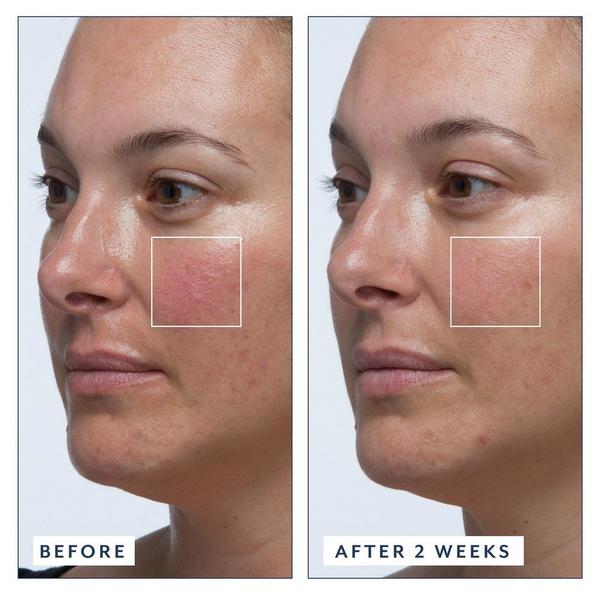 Bloomeffects Royal Tulip Vitamin C Facial Oil #6