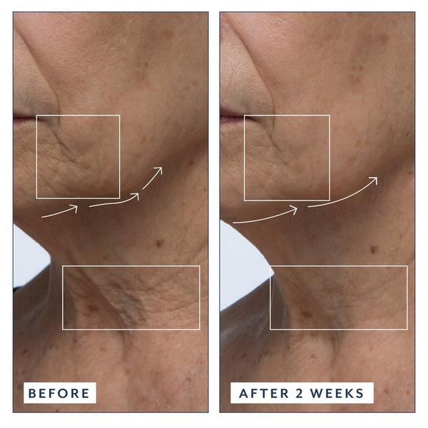 Bloomeffects Royal Tulip Vitamin C Facial Oil #7