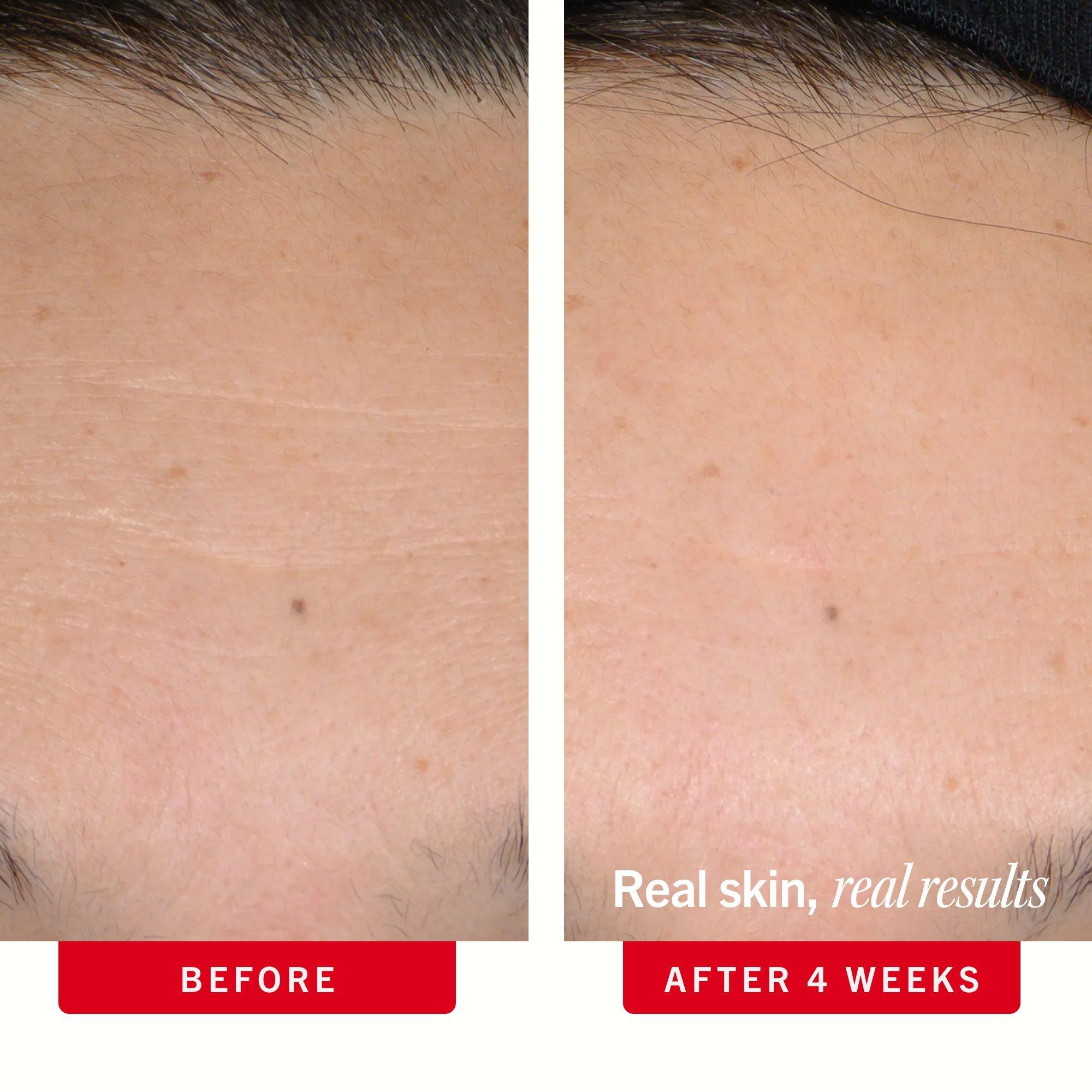 Сыворотка с ретинолом First Aid Beauty Ultra Repair — фото 4