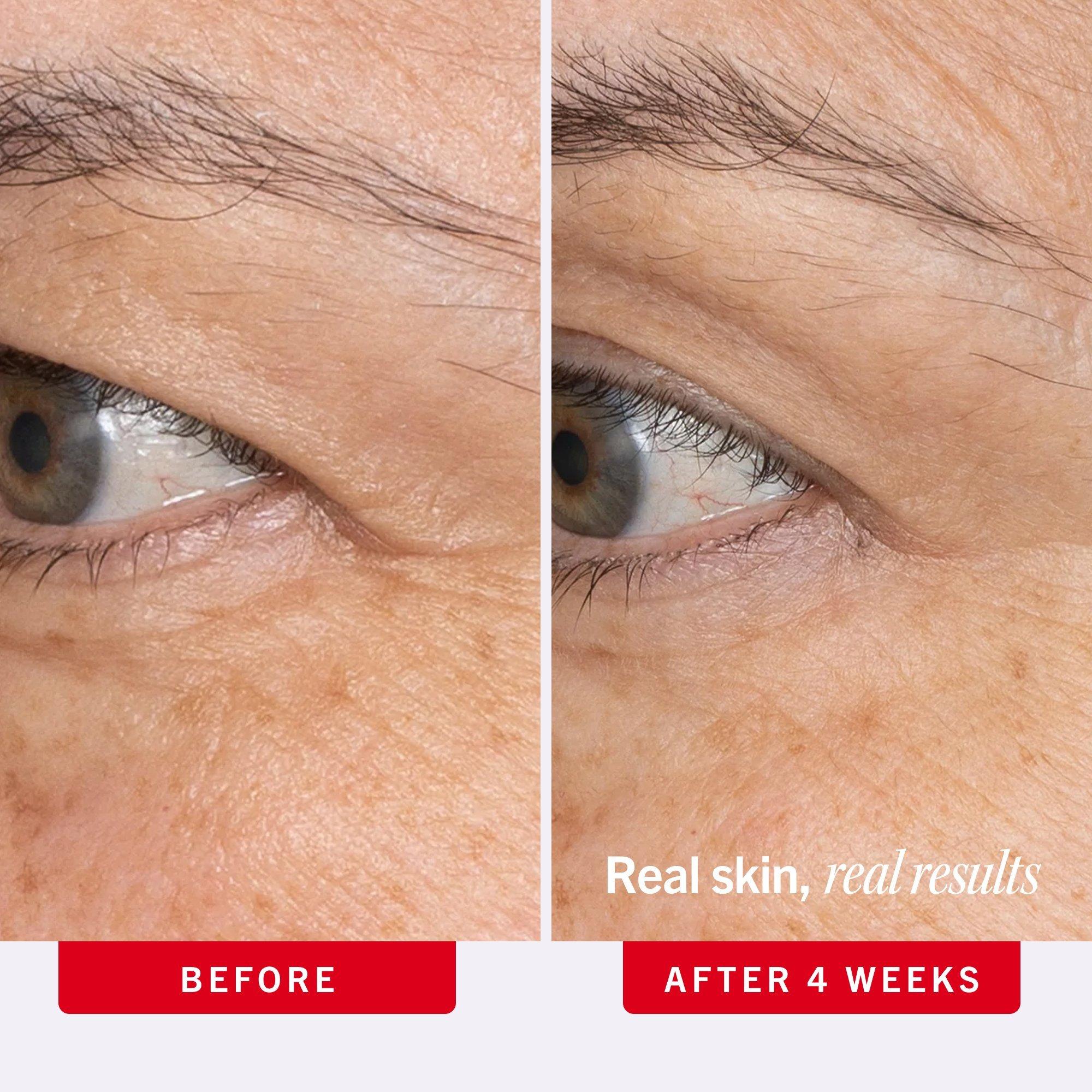 Крем для кожи вокруг глаз с ретинолом First Aid Beauty Ultra Repair — фото 4