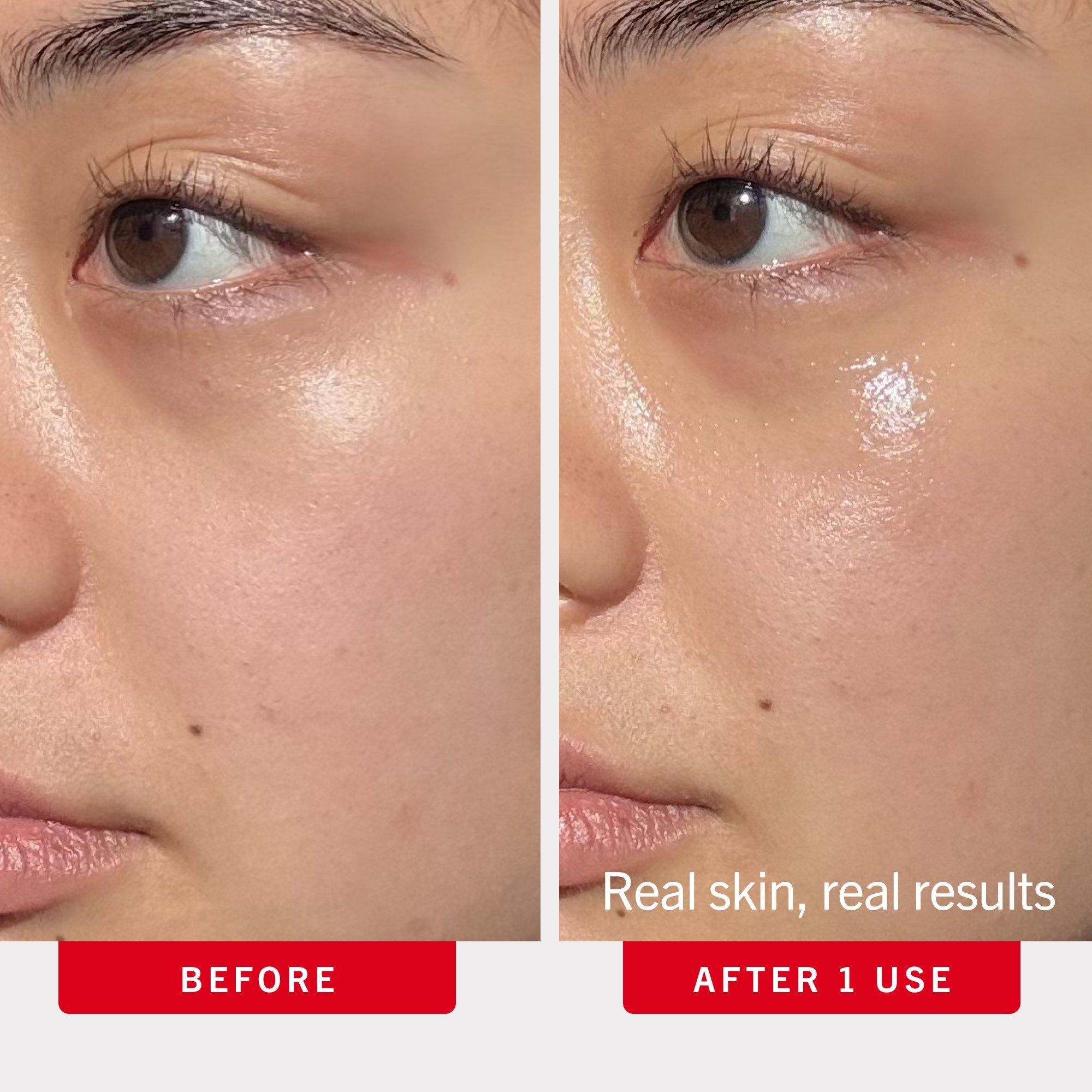 Увлажняющий крем для кожи вокруг глаз против отёков First Aid Beauty Ultra Repair — фото 4