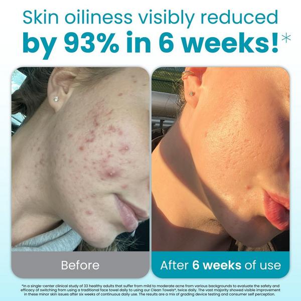 Clean Skin Club Clean Towels Blemish Control Disposable Face Towels #2