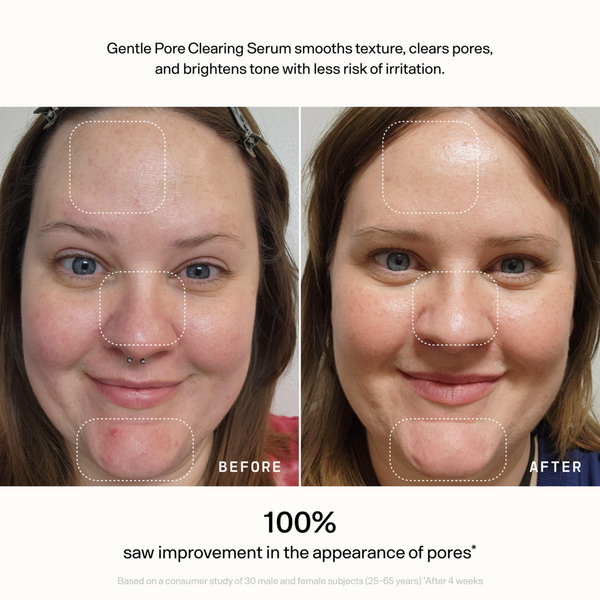 Versed Skin Refine Gentle Pore Clearing Serum #4