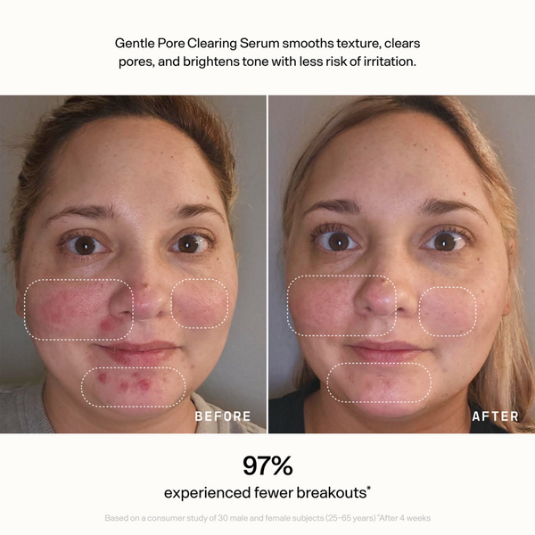 Versed Skin Refine Gentle Pore Clearing Serum #5