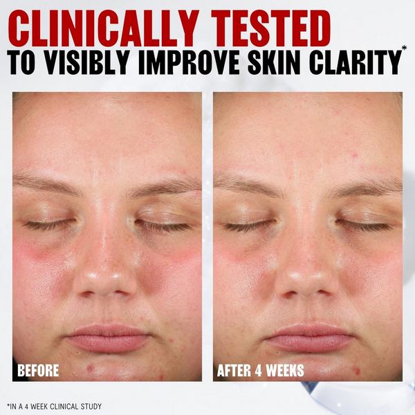 Thayers Pore Refining Pads #3