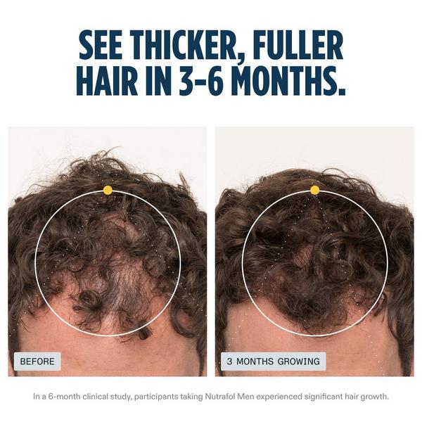 NUTRAFOL Men's Clinically Proven Hair Growth Supplement #2