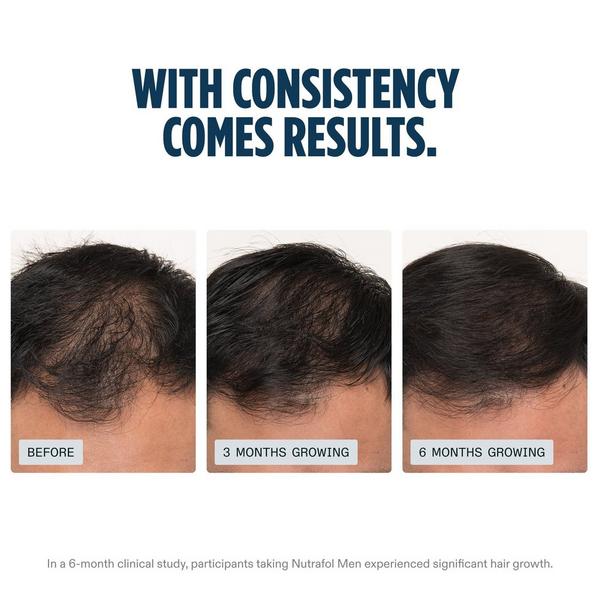 NUTRAFOL Men's Clinically Proven Hair Growth Supplement #3