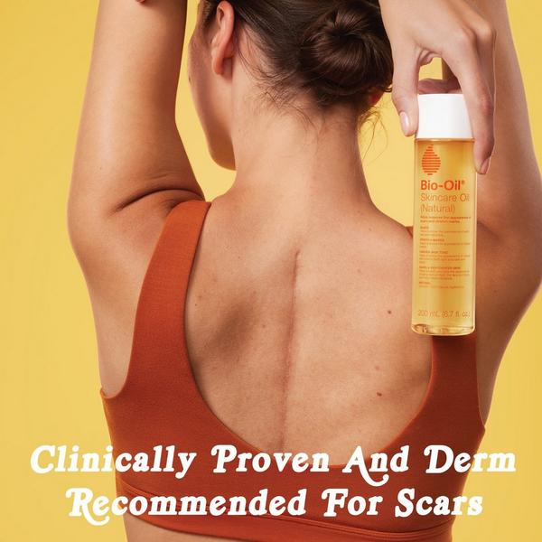 Bio-Oil Natural Skincare Oil for Scars and Stretch Marks #3