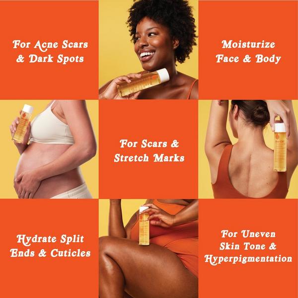 Bio-Oil Natural Skincare Oil for Scars and Stretch Marks #5
