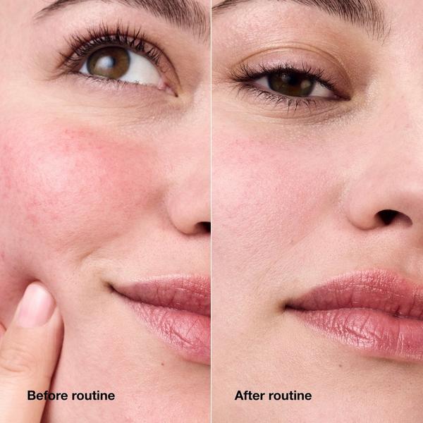 Clinique Redness Relief Skincare Set #3