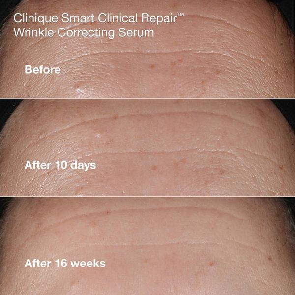 Clinique Anti-Aging Routine Skincare Gift Set #4