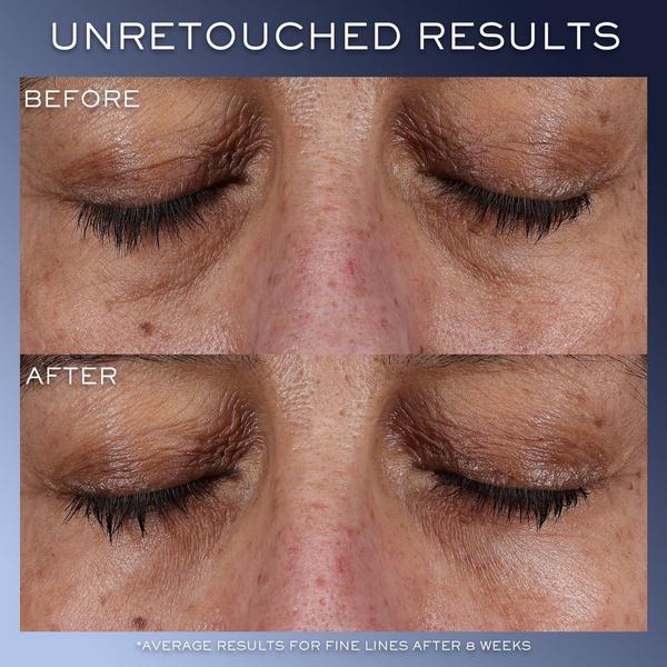 Lancôme Génifique Ultimate Serum Mother's Day Skincare Set #8