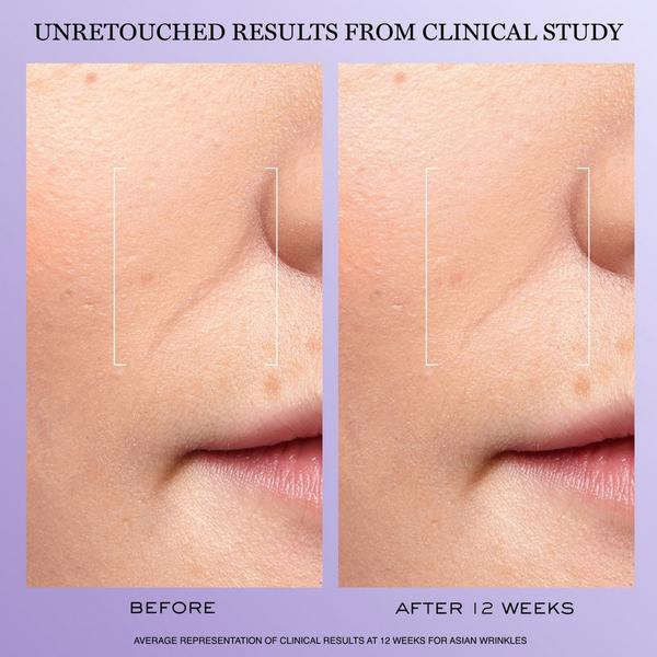 Lancôme Rénergie H.C.F. Triple Serum Discovery Gift Set #4