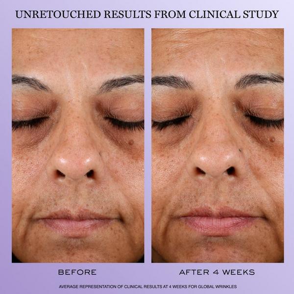 Lancôme Rénergie Starter Set #4