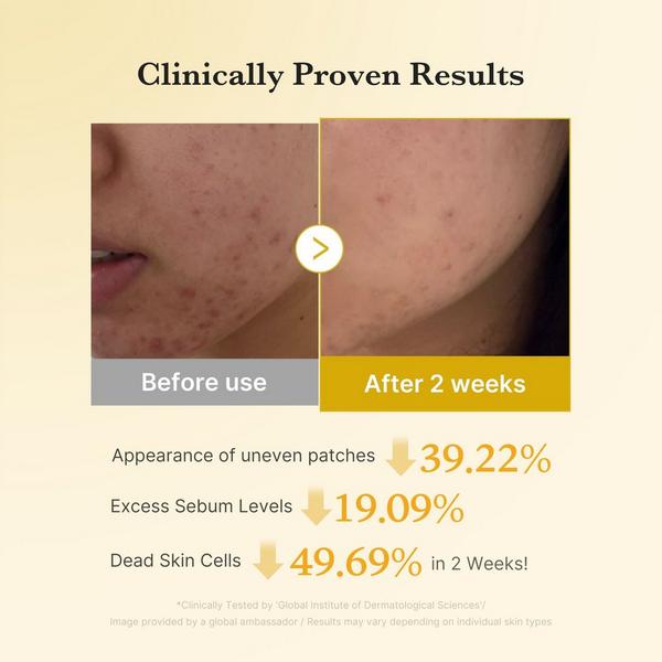 medicube Kojic Acid Turmeric Pad #4