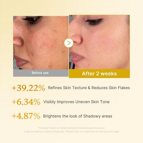 medicube Kojic Acid Turmeric Resurfacing Toner #4