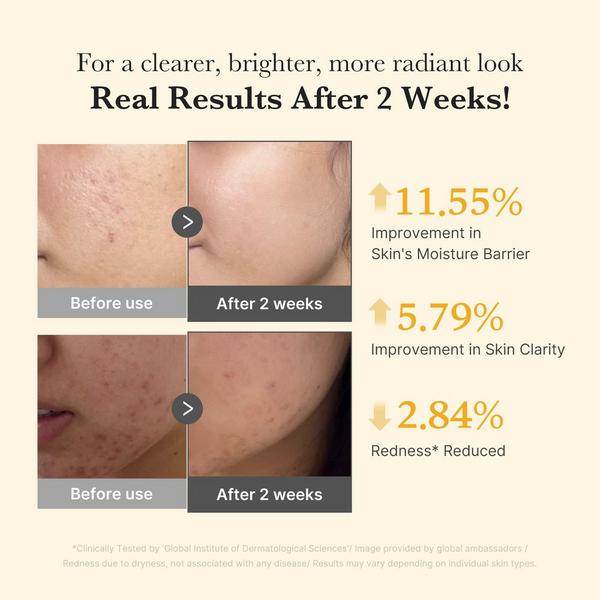 medicube Kojic Acid Turmeric Niacinamide Serum #4