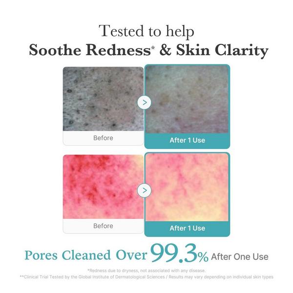 medicube Azelaic Acid Niacinamide Deep Clean Whip Cleanser #4