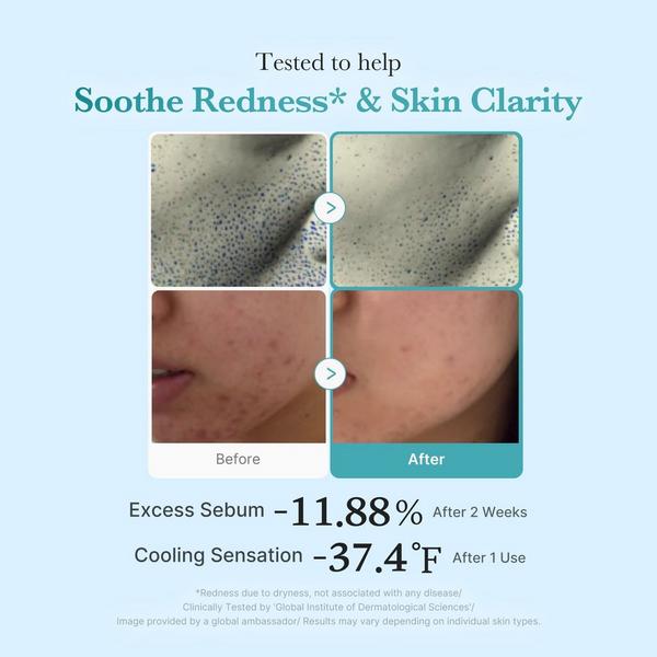 medicube Azelaic Acid Niacinamide Clarifying Toner #4