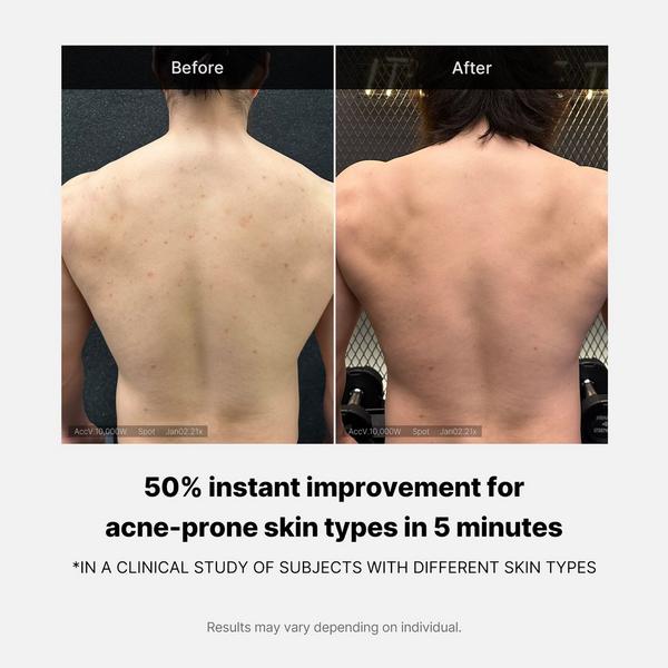 medicube Red Acne Body Wash #5