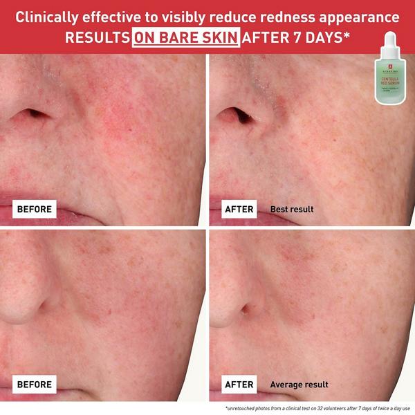 Erborian Centella Red Serum with Korean Centella Asiatica Extract #5
