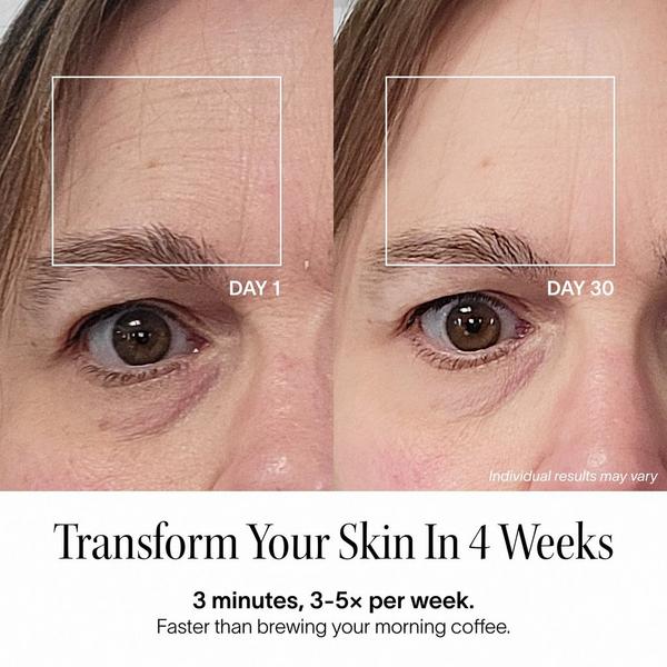 Solawave Wrinkle Retreat Pro Light Therapy Face Mask #6