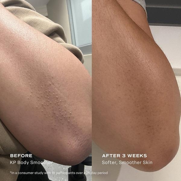 Saltair KP Body Smoother Exfoliating Milk with Glycolic Acid & Urea #6