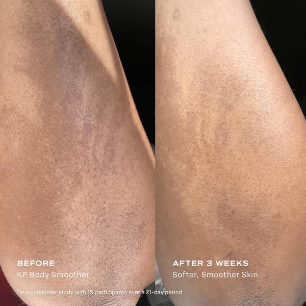 Saltair KP Body Smoother Exfoliating Milk with Glycolic Acid & Urea #7