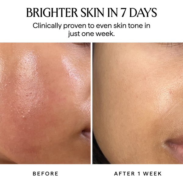 HERBIVORE NOVA 15% Vitamin C + Turmeric Brightening Serum #5