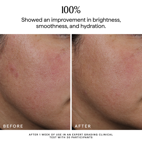 HERBIVORE NOVA Turmeric + Niacinamide Bi-Phase Glow Facial Oil #6