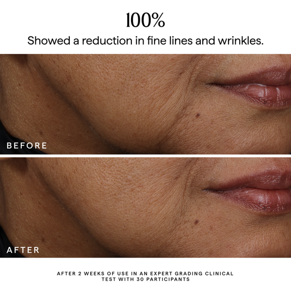 HERBIVORE BAKUCHIOL Dual-Retinol Alternative Serum #5