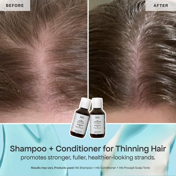 Bondi Boost HG Shed Happens Kit #3