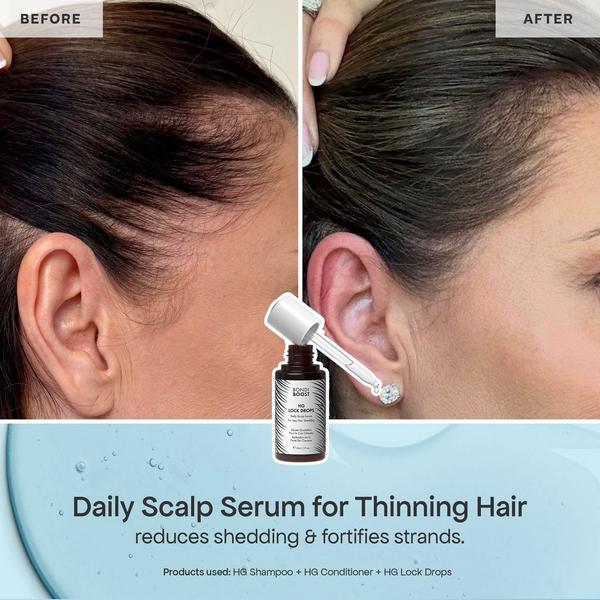 Bondi Boost HG Shed Happens Kit #4